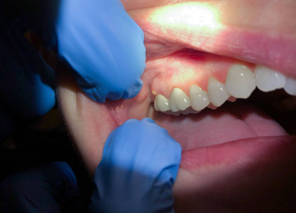 Best Emergency Dentist for Knocked-Out Tooth in Homerville, GA